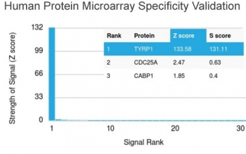 TRP1 / Tyrosinase-Related Protein-1 Antibody / TYRP1