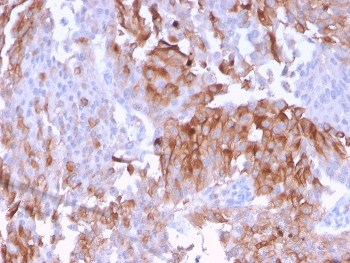UPK1B Antibody / Uroplakin 1B