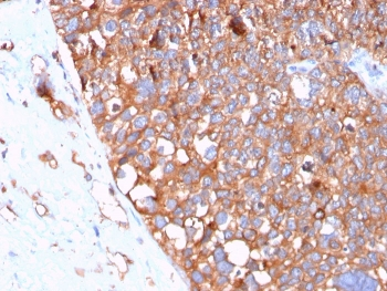 UPK1B Antibody / Uroplakin 1B
