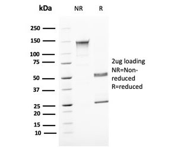 UPK1B Antibody / Uroplakin 1B