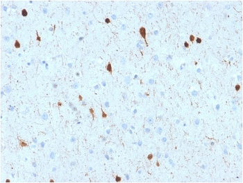 CALB2 Antibody / Calbindin 2 / Calretinin