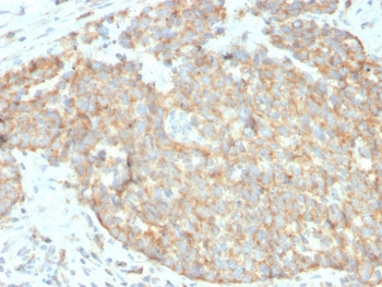 DR5 Antibody / TRAIL R2 / TNFRSF10B / CD262