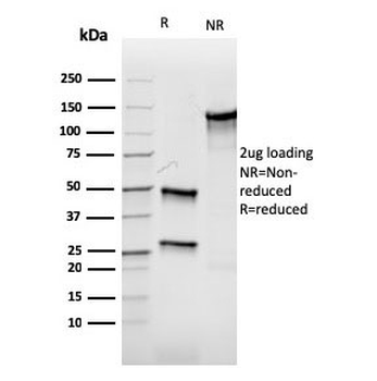 Recombinant Aurora B Antibody / AURKB