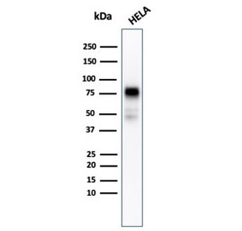 Recombinant CD44 Antibody / HCAM