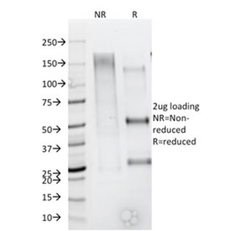 Recombinant CD44 Antibody / HCAM