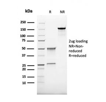 Recombinant CD68 Antibody