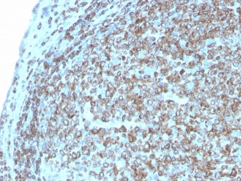Recombinant CD74 / CL Antibody