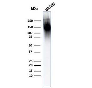 Neurofilament Antibody (Heavy + Light)
