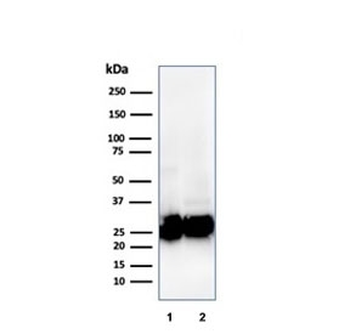 Recombinant Pan-HLA Antibody (DP/DQ/DR)
