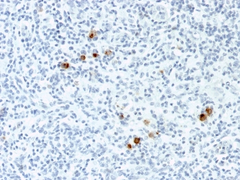 EBV Antibody / Epstein-Barr Virus / LMP-1