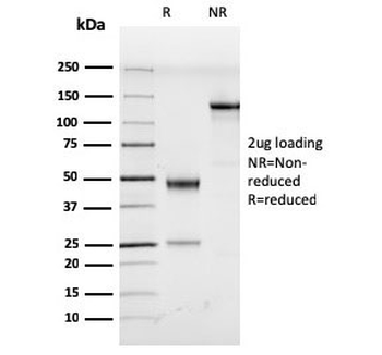 HHV8 Antibody / Herpes Virus 8