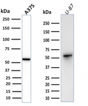 Recombinant Vimentin Antibody