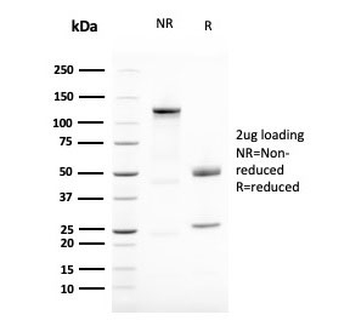 Recombinant Vimentin Antibody