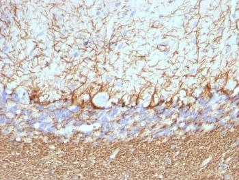 Neurofilament Antibody Cocktail (Heavy + Light)