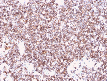 Recombinant CD45 Antibody