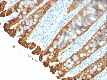 Recombinant Cytokeratin 8/18 Antibody