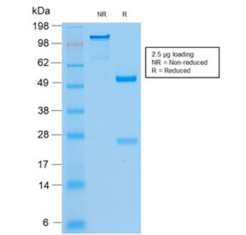 Recombinant Cytokeratin 8/18 Antibody