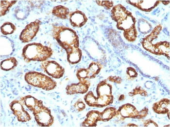 Recombinant AMACR Antibody