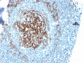 Recombinant CD23 Antibody