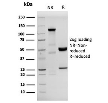 Recombinant HHV8 Antibody