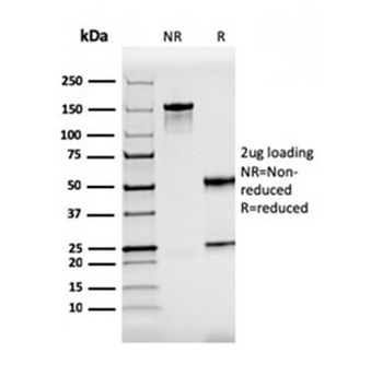 Recombinant ZAP70 Antibody