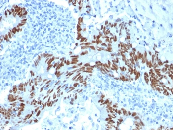 TP53 Antibody / p53
