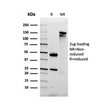 Alpha-2-Macroglobulin Antibody / A2M
