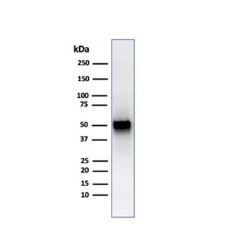 Recombinant PD-ECGF Antibody / Thymidine Phosphorylase