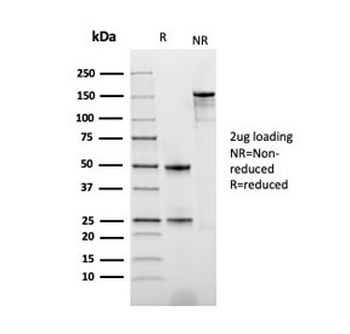 Recombinant PD-ECGF Antibody / Thymidine Phosphorylase