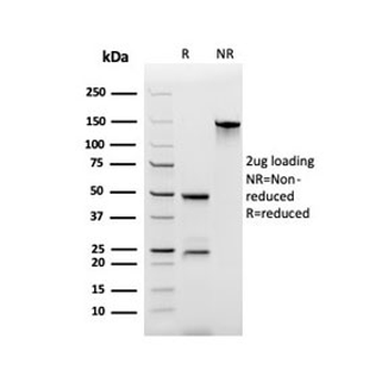 Recombinant Secretory Component Antibody / ECM1