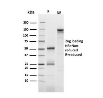 CD25 Antibody / IL2RA