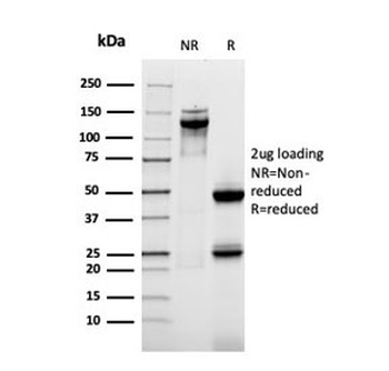 Recombinant Mucin-1 Antibody / MUC1