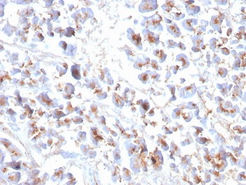 Recombinant EPX Antibody / Eosinophil Peroxidase