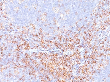 Recombinant CD4 Antibody