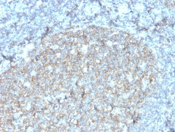 Recombinant CD81 Antibody
