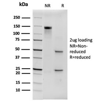 Histidine Antibody / His Tag