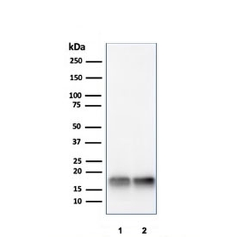 SOD1 Antibody / Superoxide Dismutase 1
