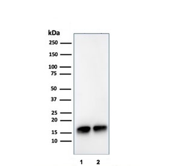 SOD1 Antibody / Superoxide Dismutase 1