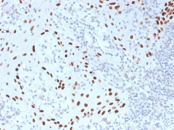 Recombinant p40 Antibody / deltaNp63