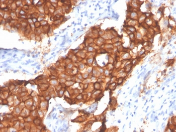 HER2 Antibody / ErbB2 / Extracellular region