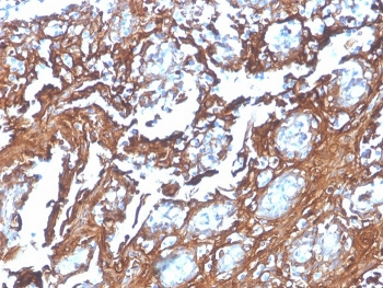 Recombinant Annexin A1 Antibody