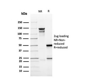 Recombinant CD137 Antibody / 4-1BB / TNFRSF9