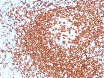 Recombinant PAX5 Antibody
