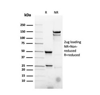 Recombinant CD22 Antibody / BL-CAM