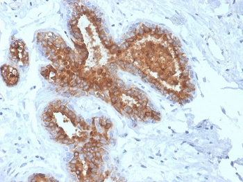 Recombinant MUC1 Antibody / Mucin-1