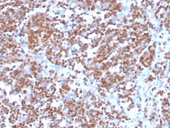 Recombinant Cyclin D1 Antibody