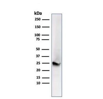 Recombinant PGP9.5 Antibody