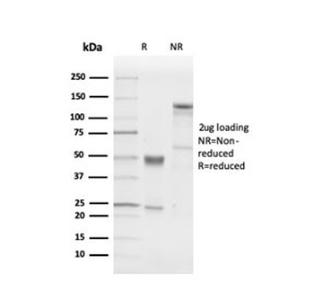 Recombinant PGP9.5 Antibody