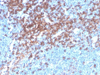 Recombinant CD4 Antibody