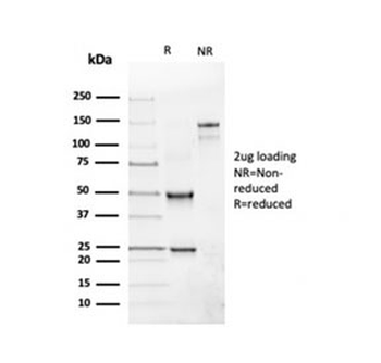 Recombinant CD19 Antibody